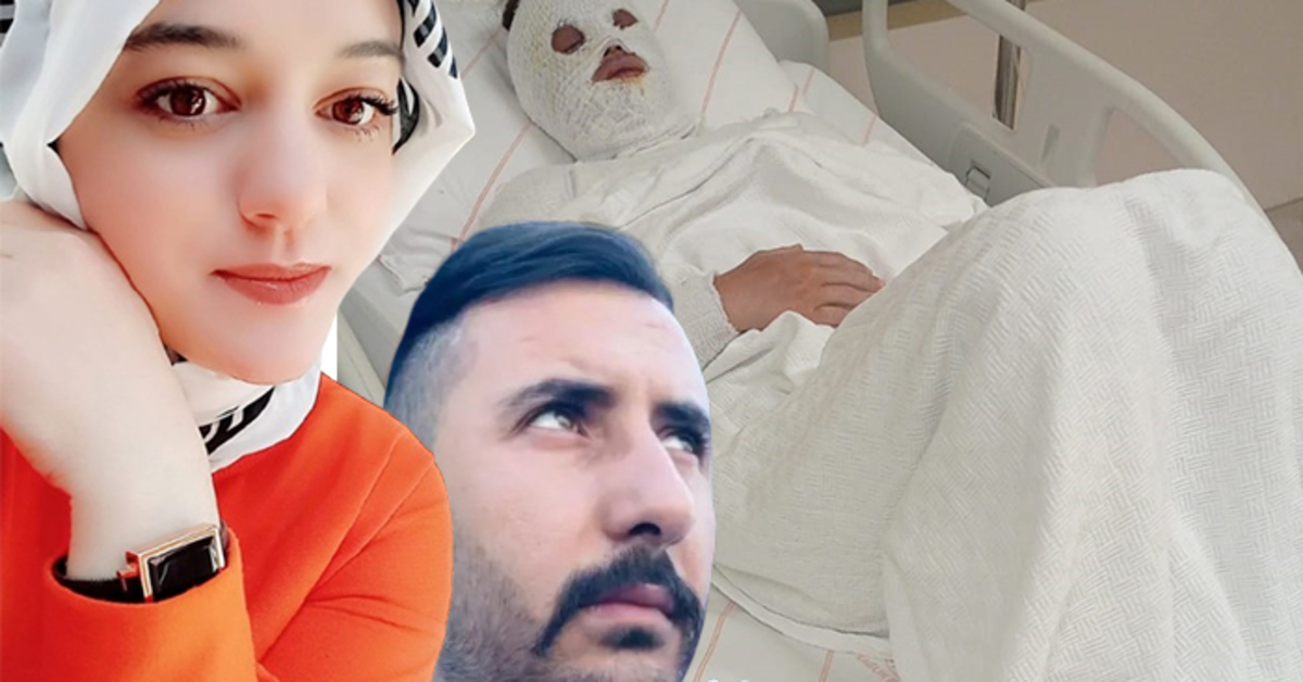 Eski nişanlısının yüzüne kimyasal madde atmıştı: Akıl sağlığı yerinde çıktı