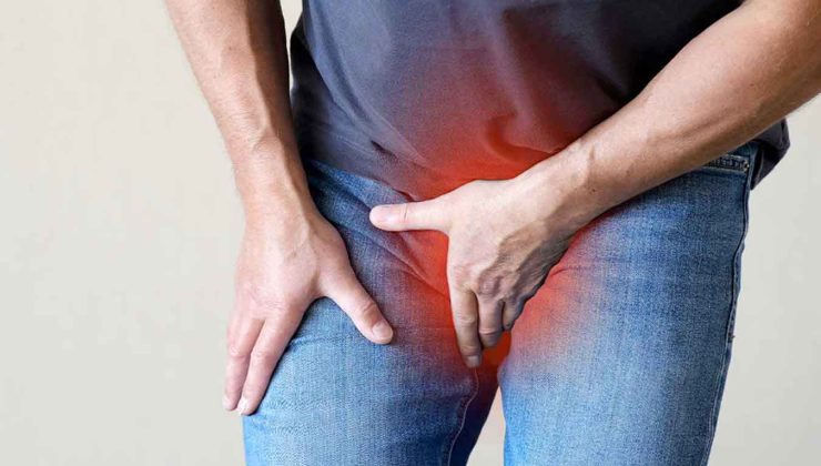 Varikosel Tedavisinde Güvenilir Yaklaşım: 30 Yıllık Deneyim ve 6000+ Başarılı Varikosel Operasyonu